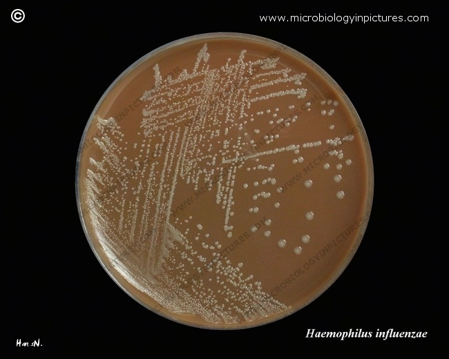 haemophilus influenzae group b